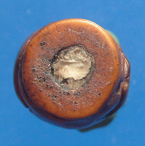 กุมารดูดรก