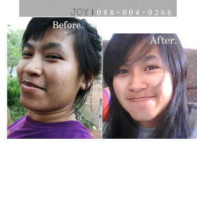 รีวิวผลิตภัณฑ์ จากคุณเดี้ยน