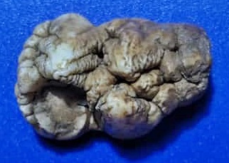 คตฟันกรามเสือ