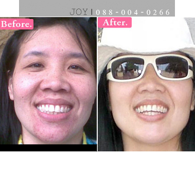 รีวิวผลิตภัณฑ์ จากคุณมี่ พัฒนาการ